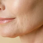 How to get rid of wrinkles around the mouth?