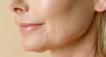 How to get rid of wrinkles around the mouth?
